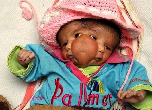 Detail Foto Bayi Teraneh Di Dunia Nomer 33