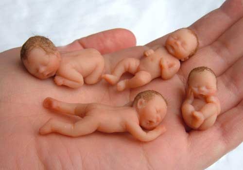 Detail Foto Bayi Yang Di Aborsi Nomer 24