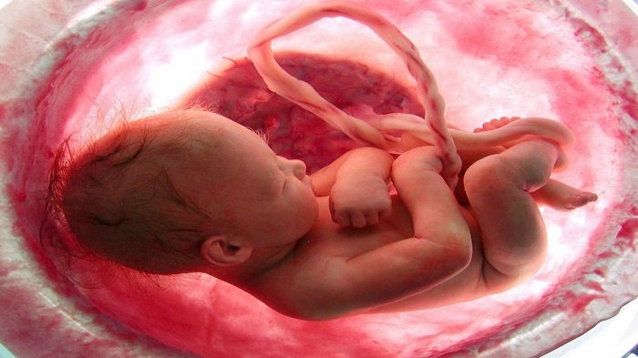 Detail Foto Bayi Yang Di Aborsi Nomer 25