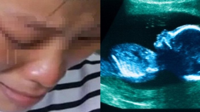 Detail Foto Bayi Yang Di Aborsi Nomer 32
