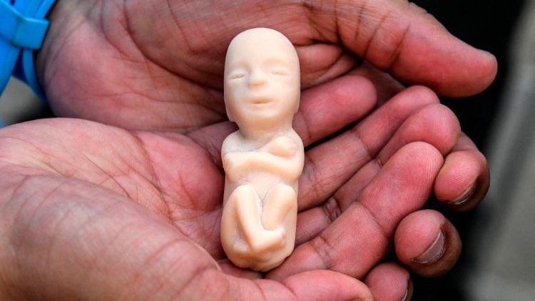 Detail Foto Bayi Yang Di Aborsi Nomer 42