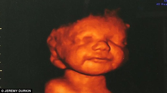 Detail Foto Bayi Yang Di Aborsi Nomer 51
