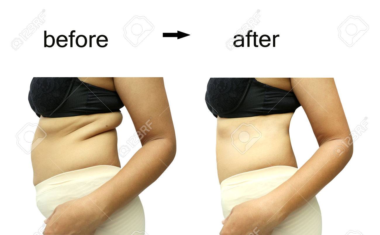 Detail Foto Before After Diet Nomer 16