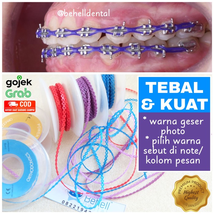 Detail Foto Behel Karet Nomer 26