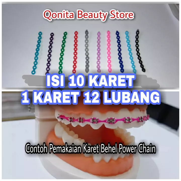 Detail Foto Behel Karet Nomer 8