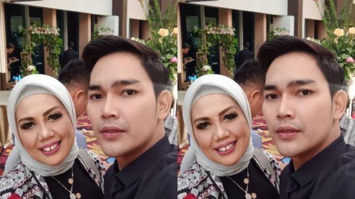 Detail Foto Elly Sugigi Setelah Potong Gigi Nomer 11