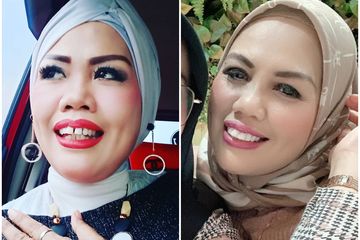 Detail Foto Elly Sugigi Setelah Potong Gigi Nomer 13