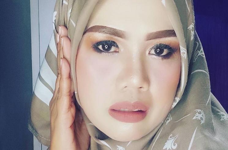 Detail Foto Elly Sugigi Setelah Potong Gigi Nomer 28