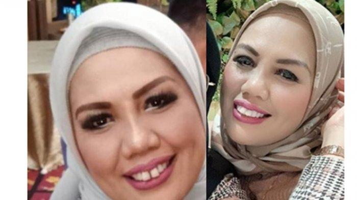 Detail Foto Elly Sugigi Setelah Potong Gigi Nomer 6