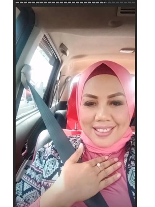 Detail Foto Elly Sugigi Setelah Potong Gigi Nomer 51