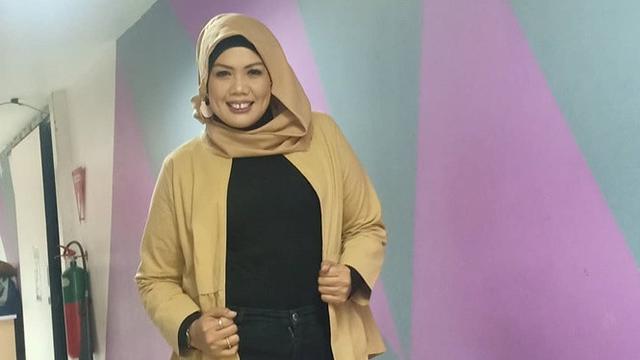 Detail Foto Elly Sugigi Setelah Potong Gigi Nomer 10