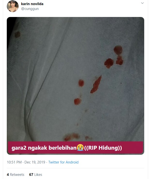 Detail Foto Hidung Berdarah Nomer 3