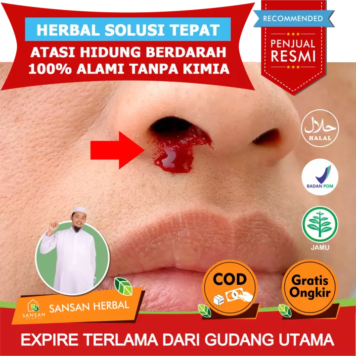 Detail Foto Hidung Berdarah Nomer 40