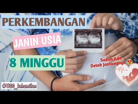 Detail Foto Janin 8 Minggu Nomer 40