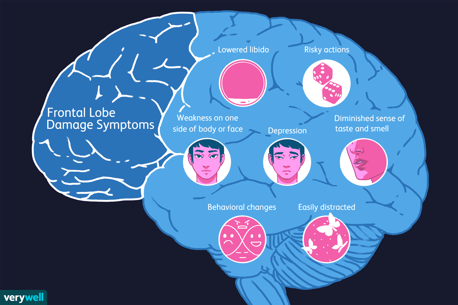 Detail Gambar Otak Manusia Kartun Nomer 11