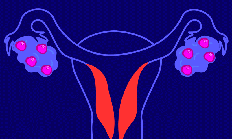 Detail Gif Menstruation Nomer 14