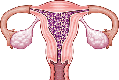 Detail Gif Menstruation Nomer 22
