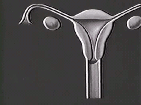 Detail Gif Menstruation Nomer 45