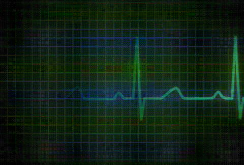 Detail Heart Rate Gif Nomer 5