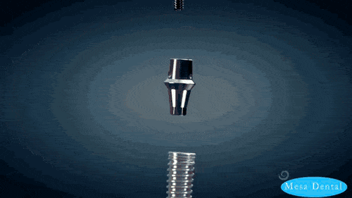 Detail Implant Gif Nomer 31