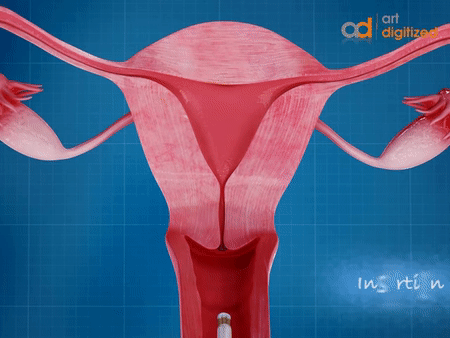 Detail Insertion Gif Nomer 4