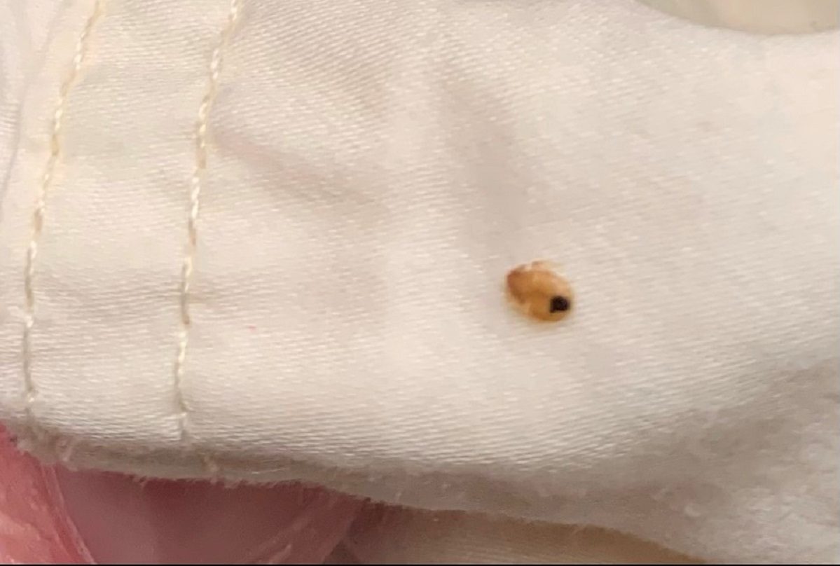 Detail Bed Bug Picture Nomer 51