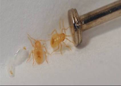 Detail Bed Bugs Image Gallery Nomer 32