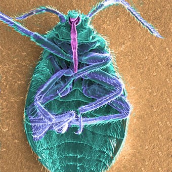 Detail Bed Bugs Image Gallery Nomer 52