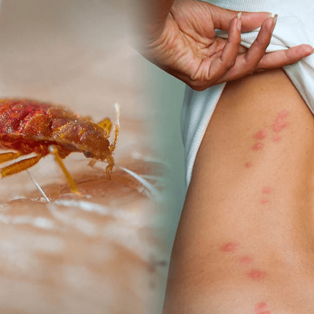 Detail Bed Bugs Pics Nomer 27