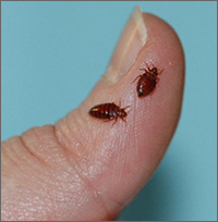 Detail Bedbugs Images Nomer 47
