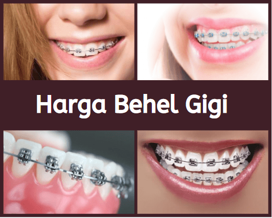 Detail Behel Gigi Png Nomer 33