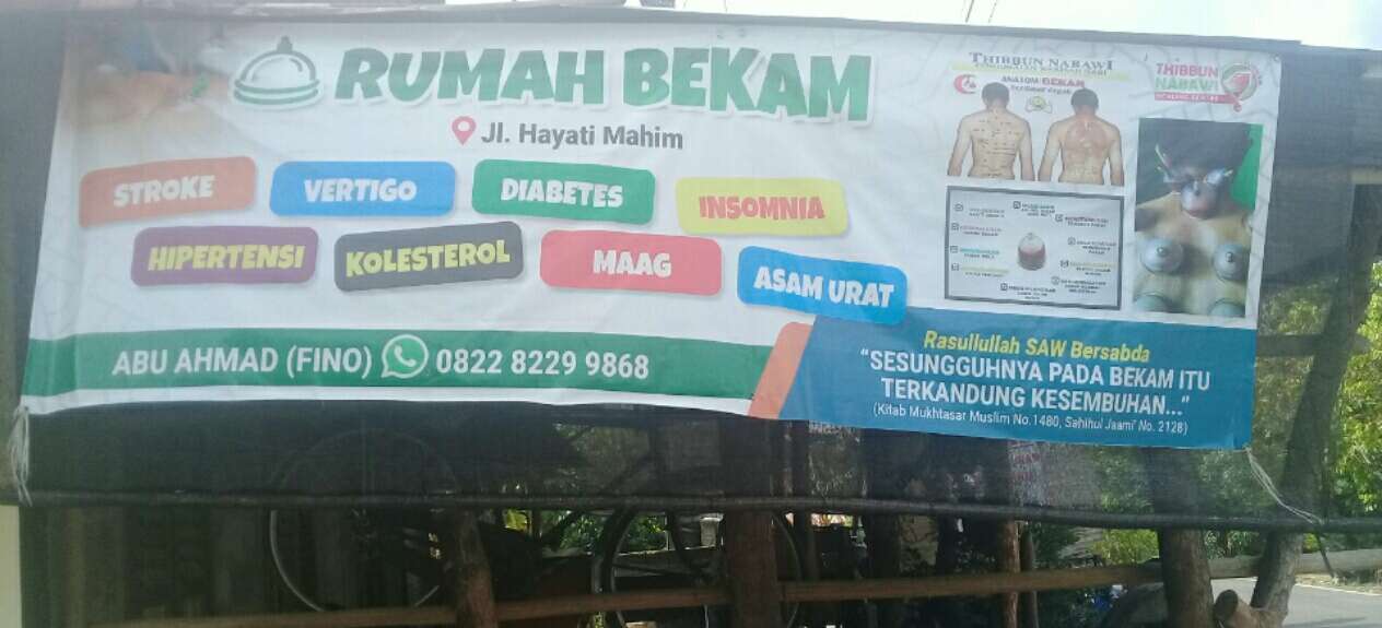 Detail Bekam Datang Ke Rumah Nomer 42