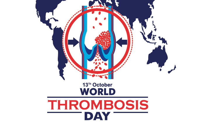 Detail Thrombose Bilder Nomer 8