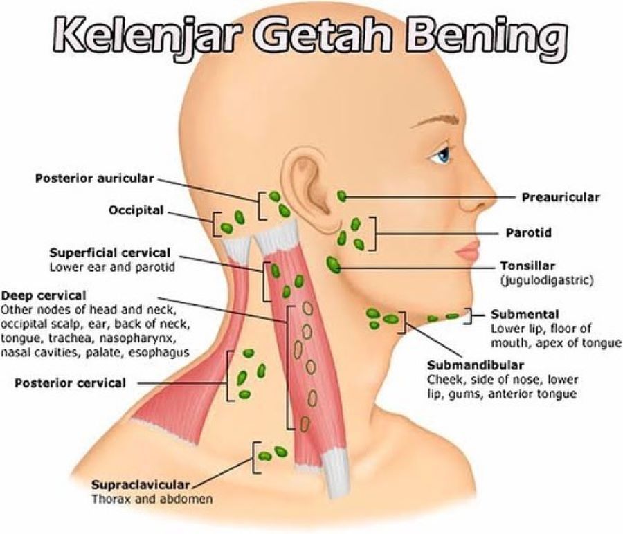 Detail Foto Kelenjar Getah Bening Nomer 7