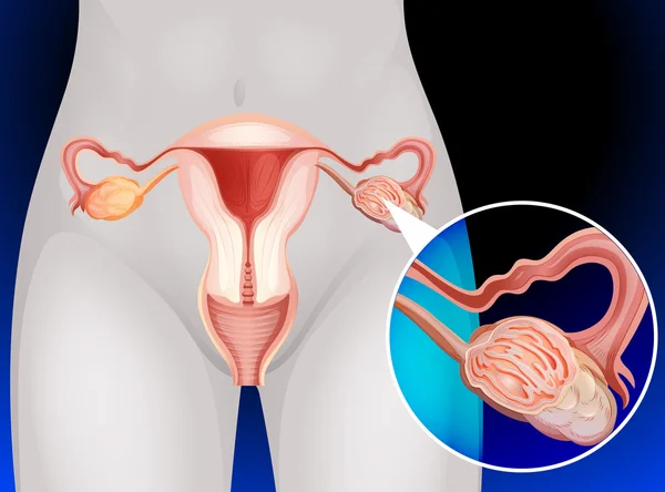 Detail Foto Kemaluan Perempuan Nomer 25