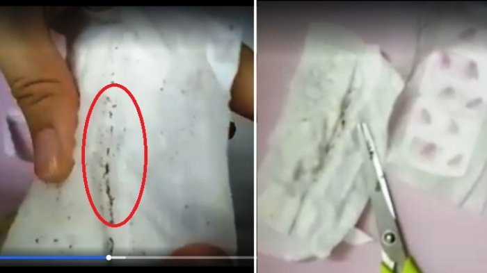 Detail Foto Kemaluan Perempuan Nomer 44