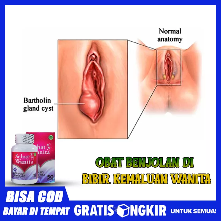 Detail Foto Kemaluan Perempuan Nomer 6