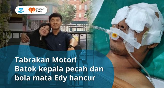 Detail Foto Kepala Pecah Nomer 52