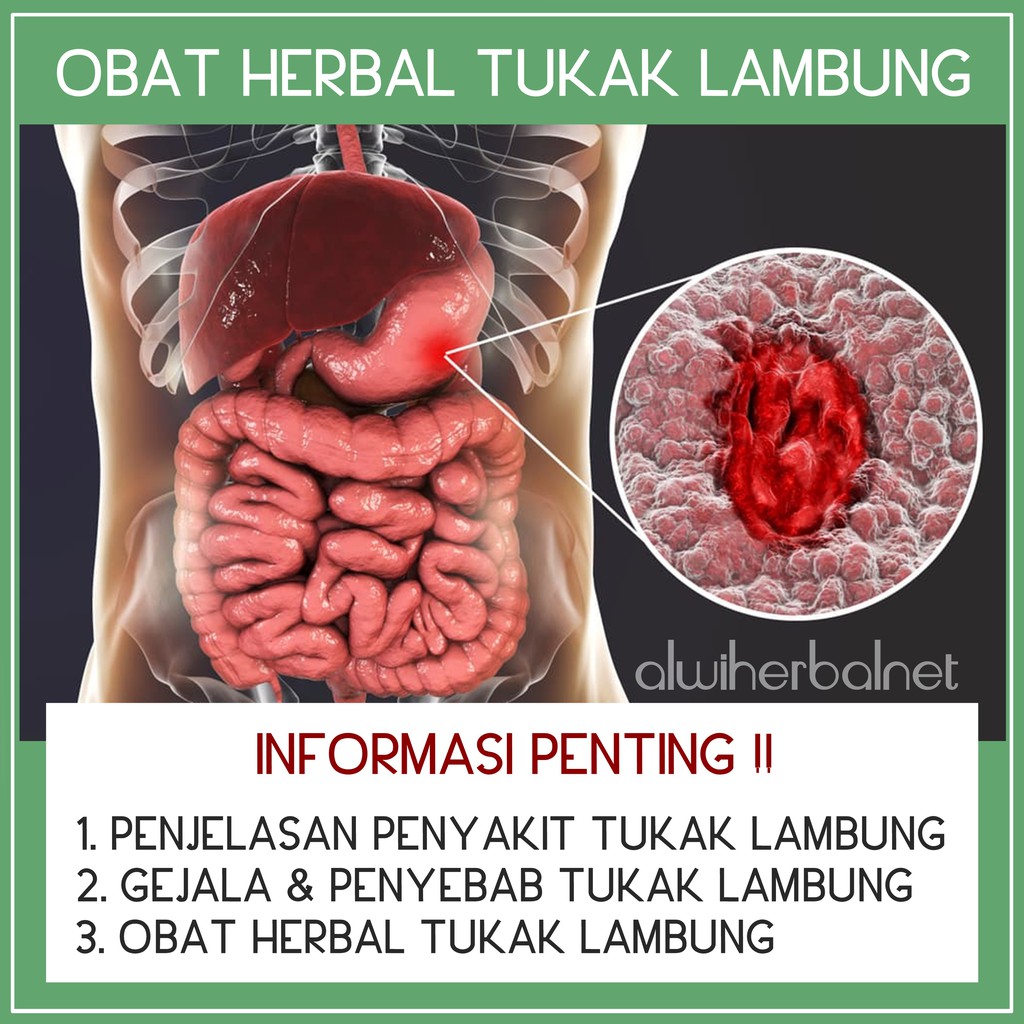 Detail Foto Lambung Luka Nomer 16