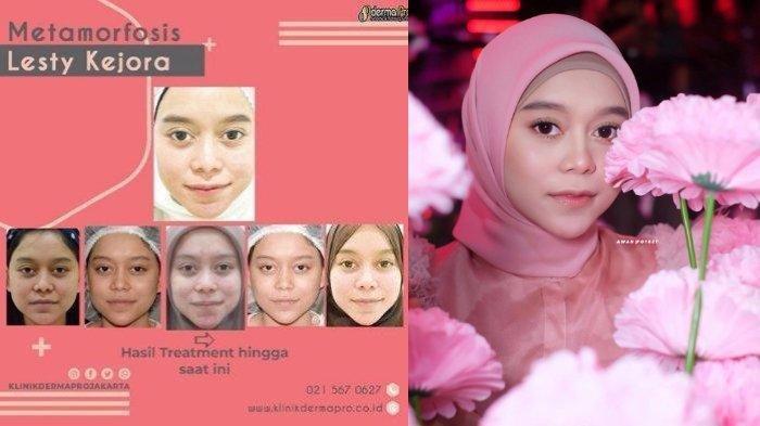 Detail Foto Lesti Sebelum Jadi Artis Nomer 4