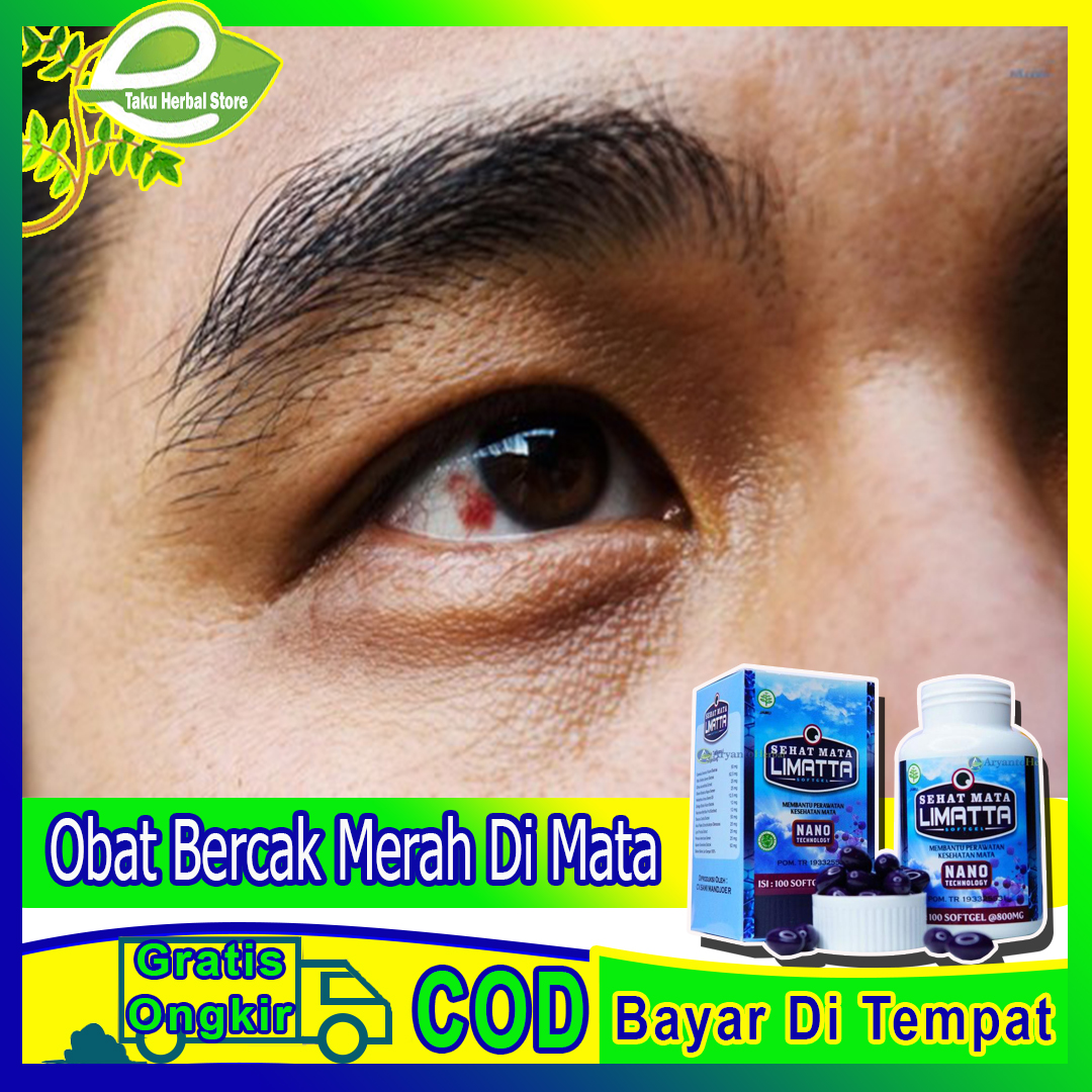 Detail Bercak Coklat Di Mata Nomer 36