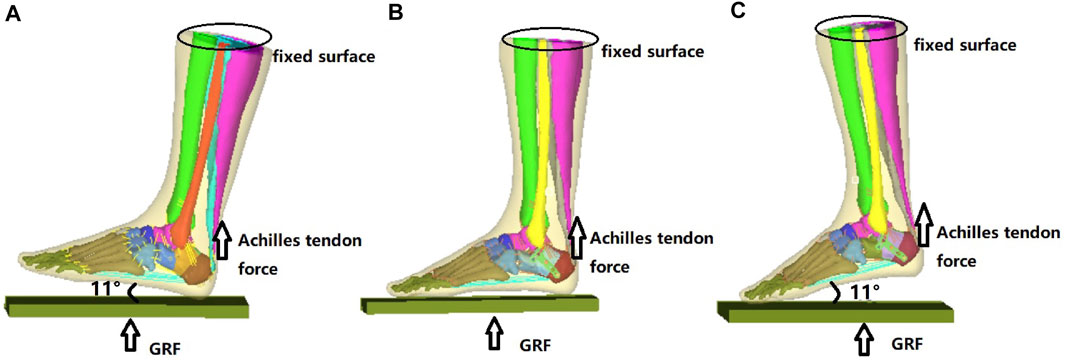 Detail Knie Hornhaut Nomer 3