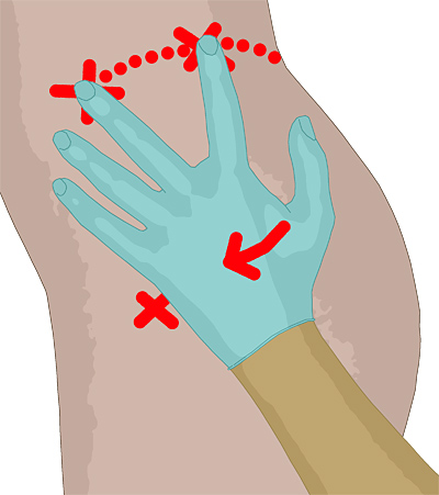 Detail Zeigefinger Anatomie Nomer 4