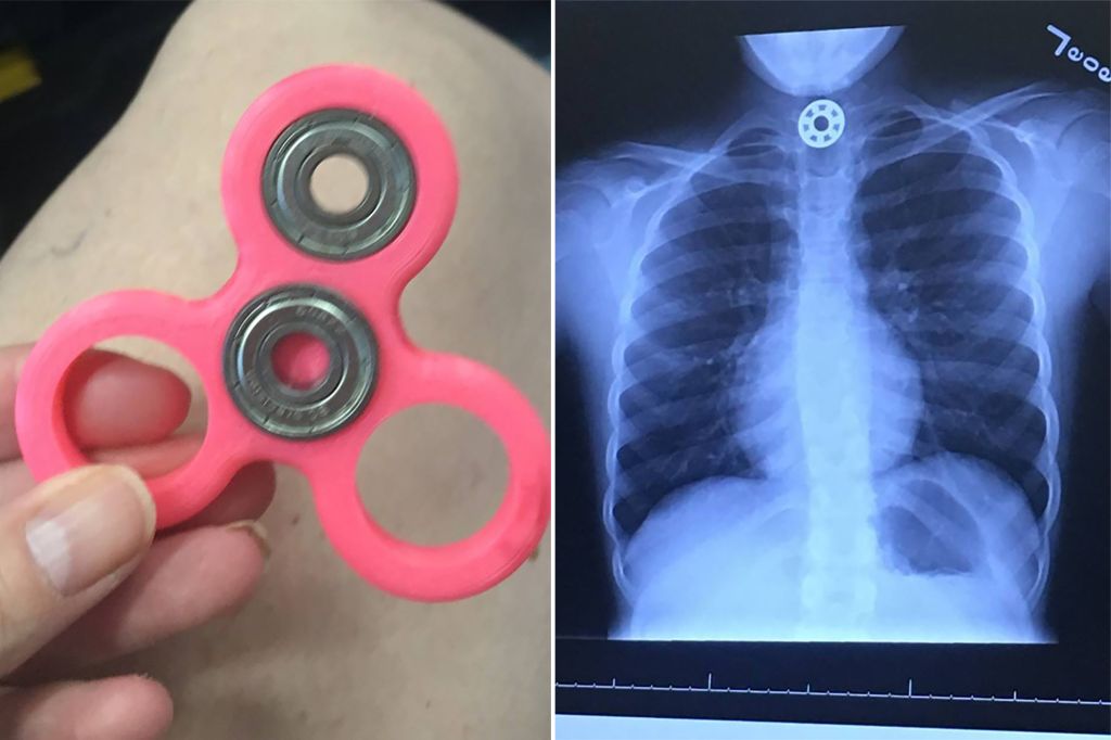 Detail A Picture Of A Fidget Spinner Nomer 21