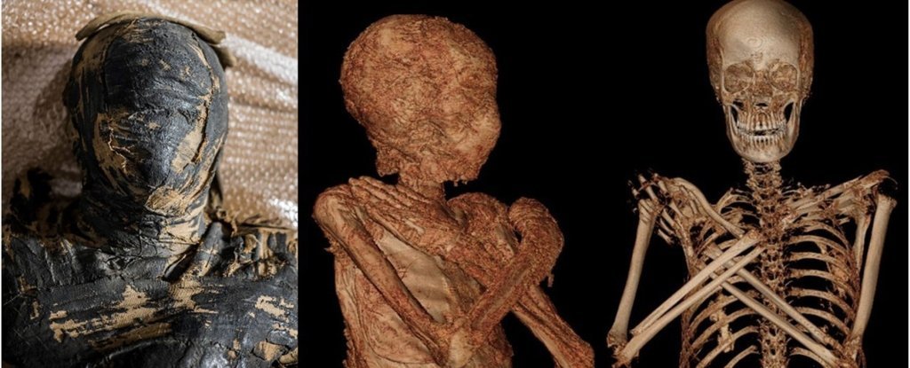 Detail A Picture Of A Mummy Nomer 13