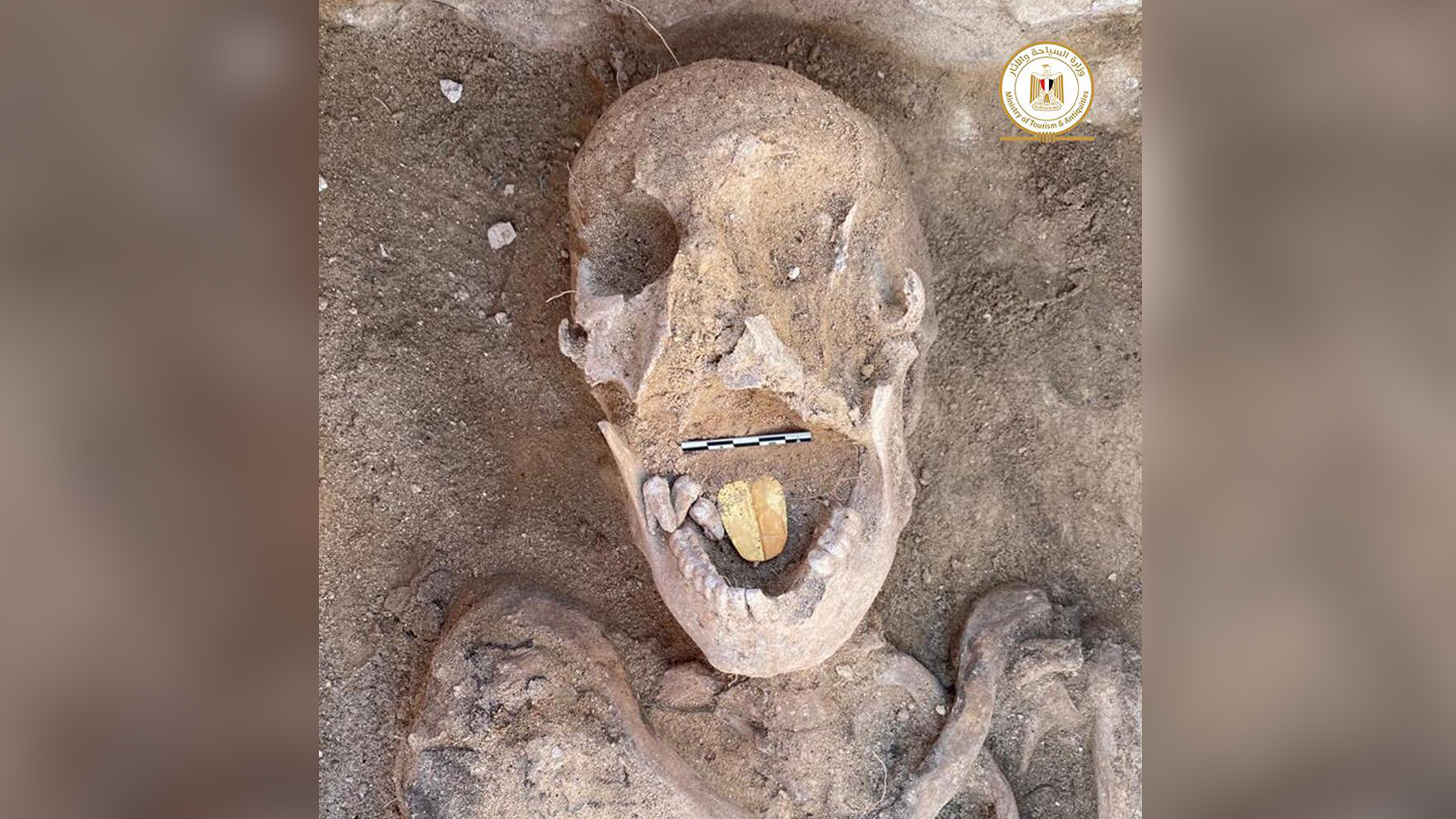 Detail A Picture Of A Mummy Nomer 23