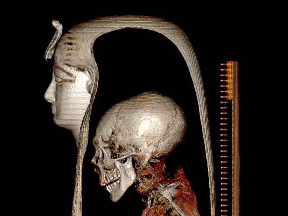 Detail A Picture Of A Mummy Nomer 25