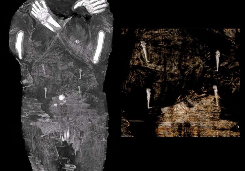 Detail A Picture Of A Mummy Nomer 42
