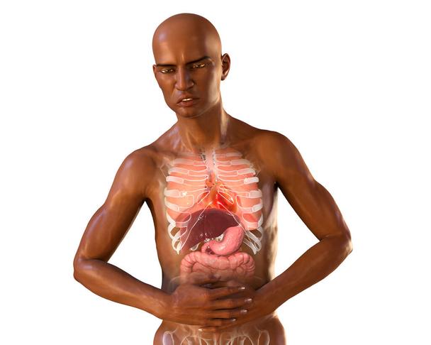 Detail Darm Anatomie Frau Nomer 18