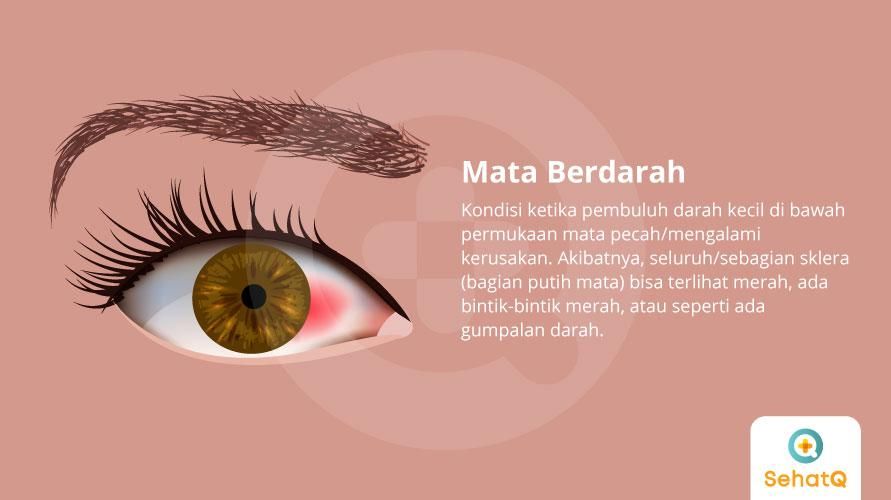 Detail Foto Mata Berdarah Nomer 9